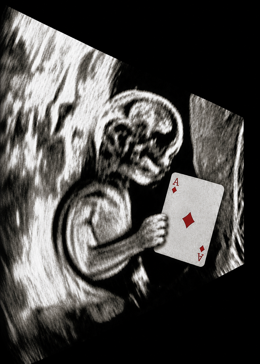 Ultrasound 2.0