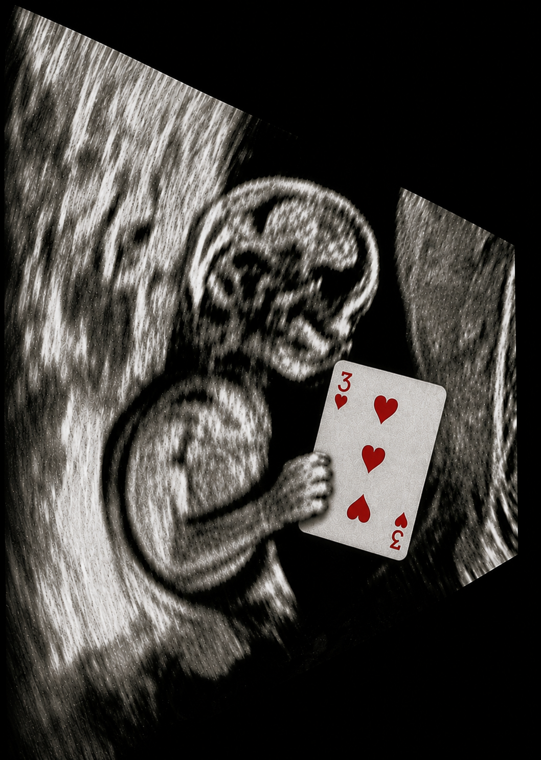 Ultrasound 2.0
